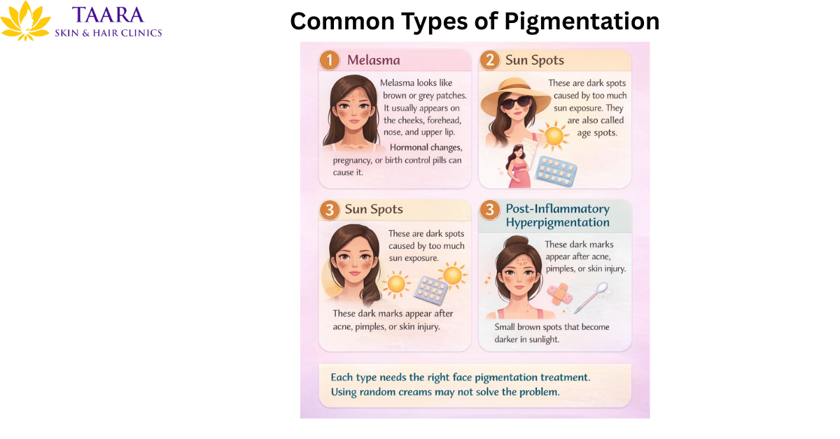 Common types of pigmentation