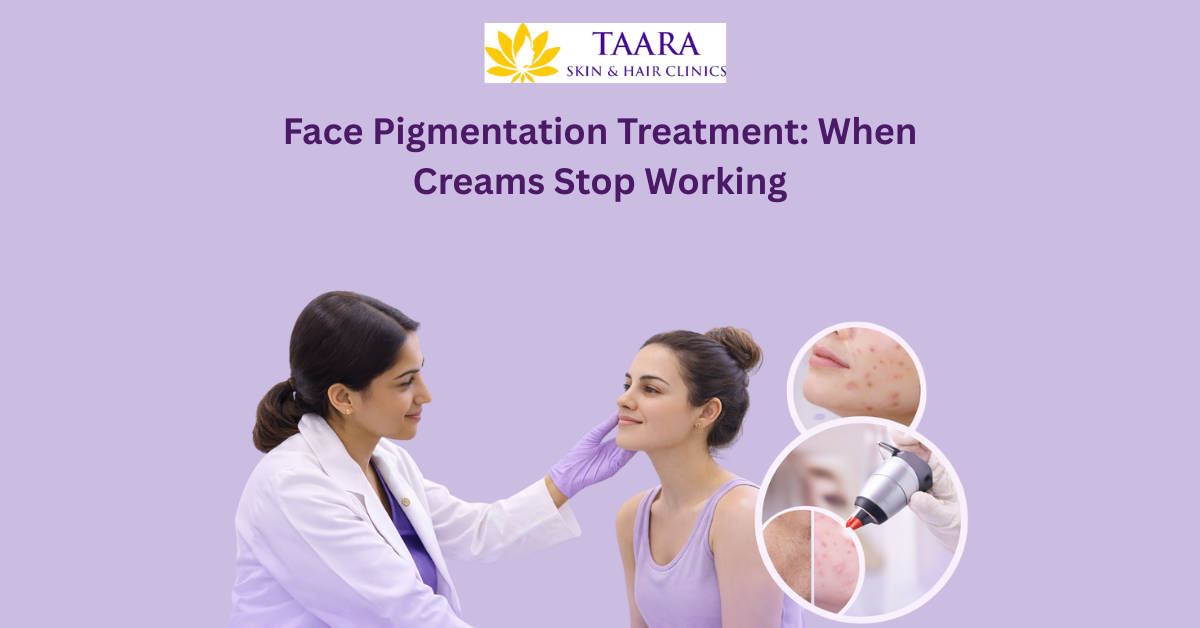 Face Pigmentation Treatment