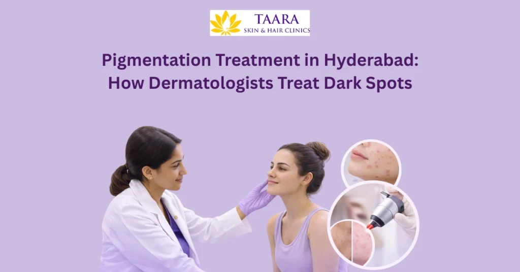 Pigmentation Treatment in Hyderabad